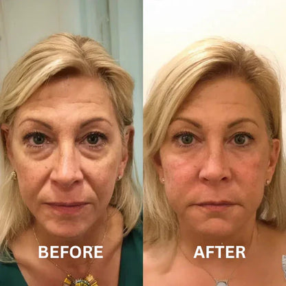 Vitala™ Insta Firm – Instant Eye & Lid Lift