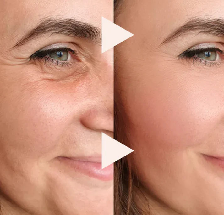 Before and after results of anti aging eye rolling serum reducing wrinkles