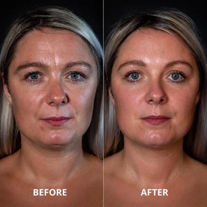 AgeLuxe™ Lift Serum