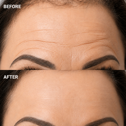 AgeLuxe™ Lift Serum