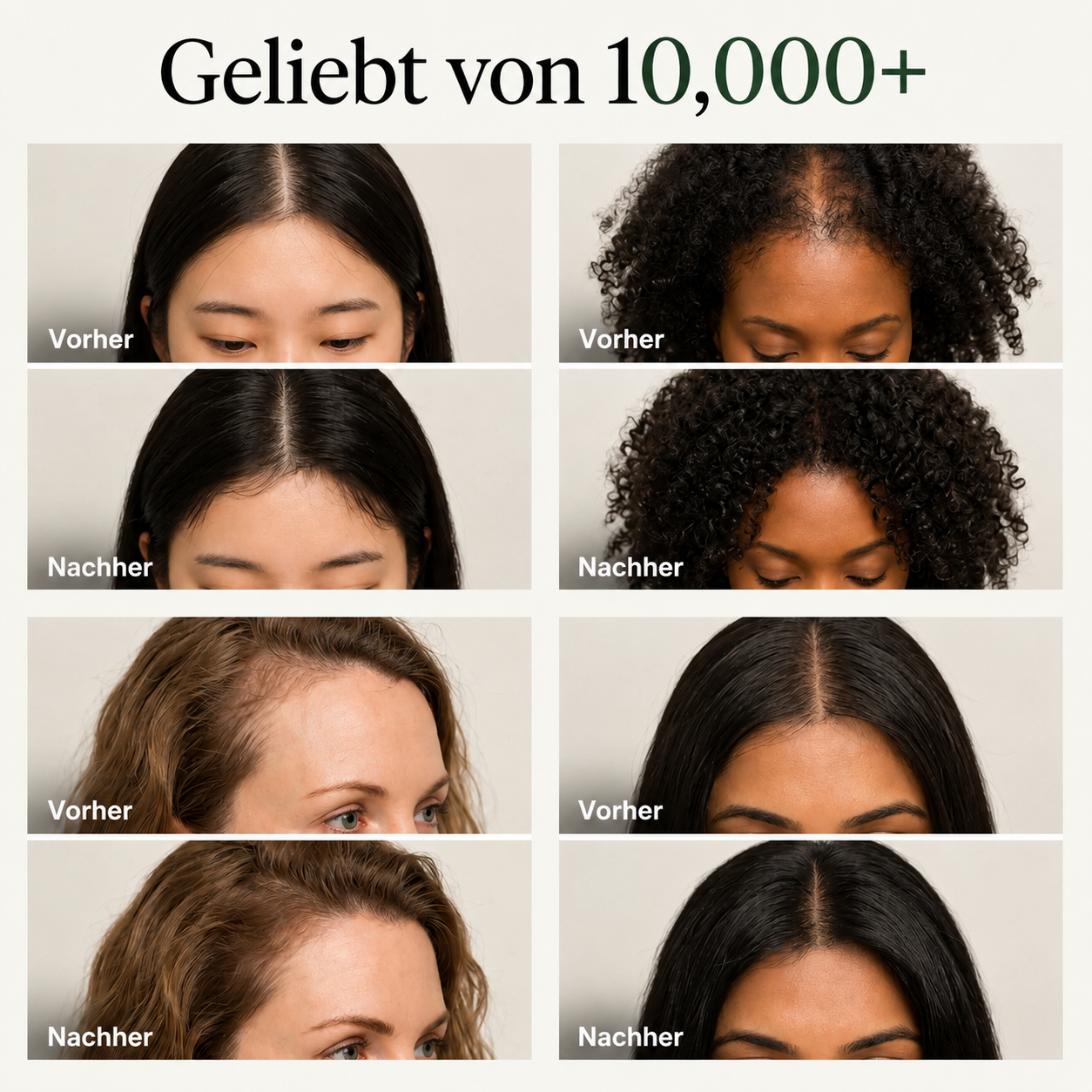 Koreanische Kopfhaut-Revitalisierungs-Bar