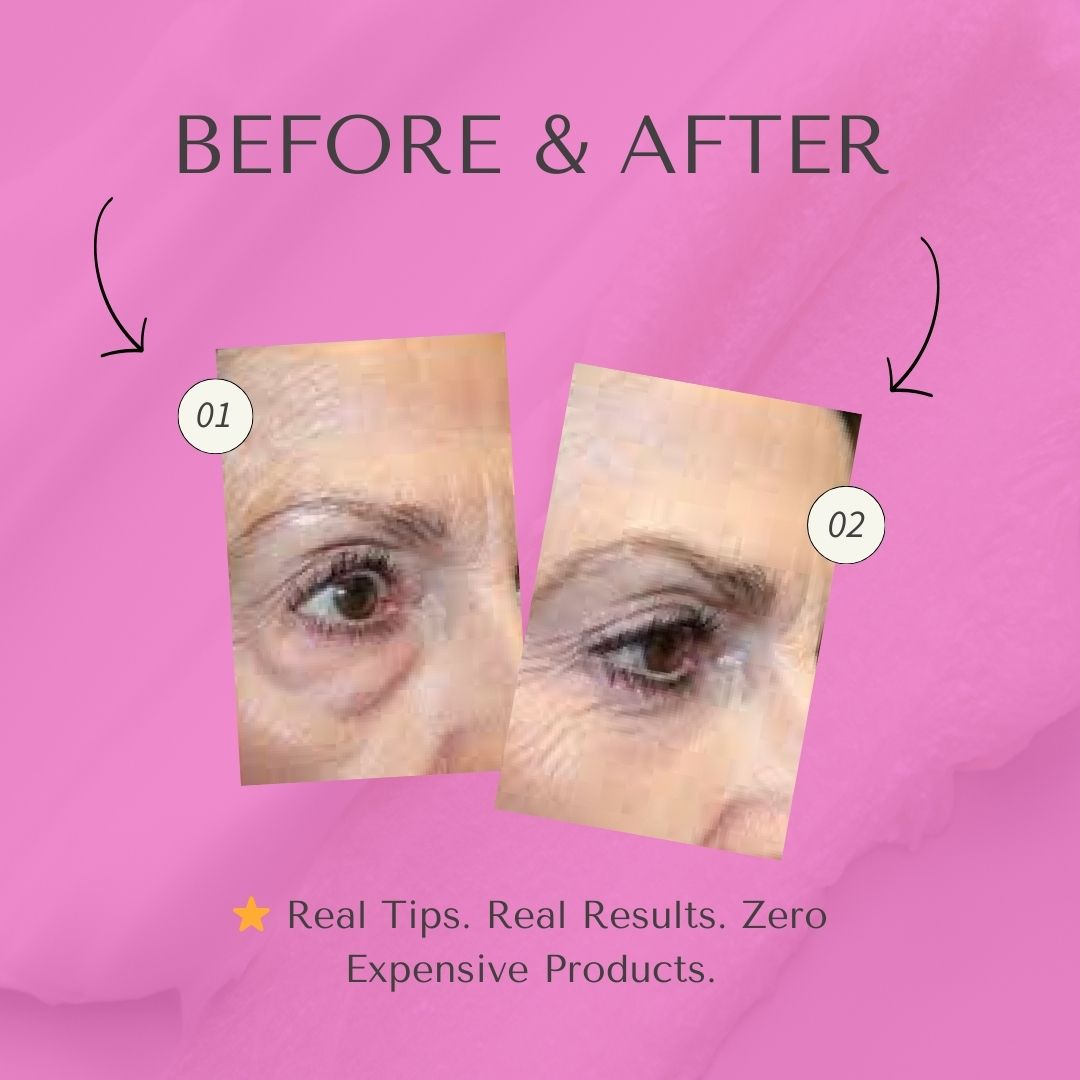 Before and after puffy eyes treatment showing reduced swelling, featured in a skincare ebook PDF